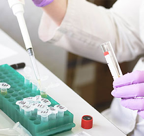 Lab Test and Diagnostics