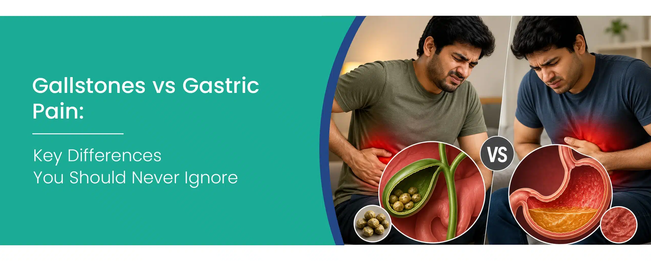 Gallstones vs Gastric Pain symptoms comparison