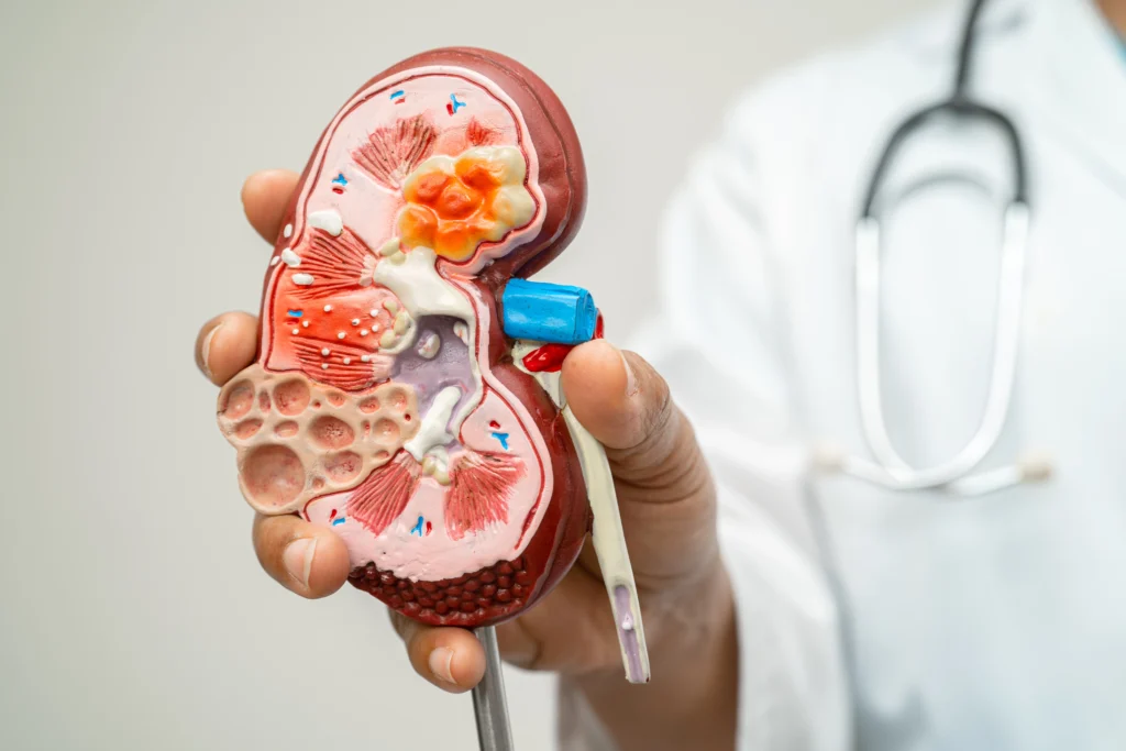 Chronic kidney disease symptoms