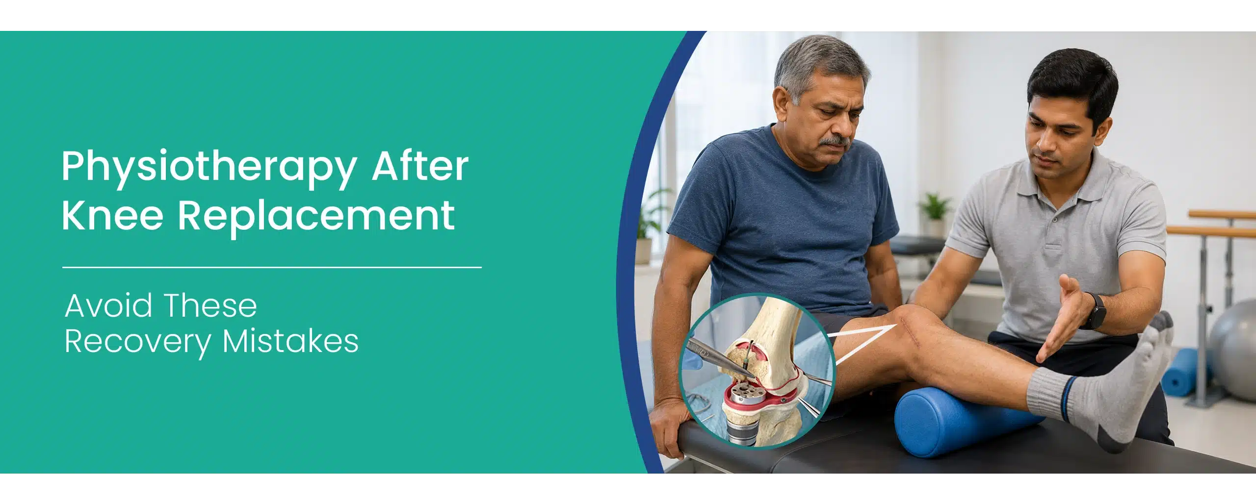 Physiotherapy After Knee Replacement