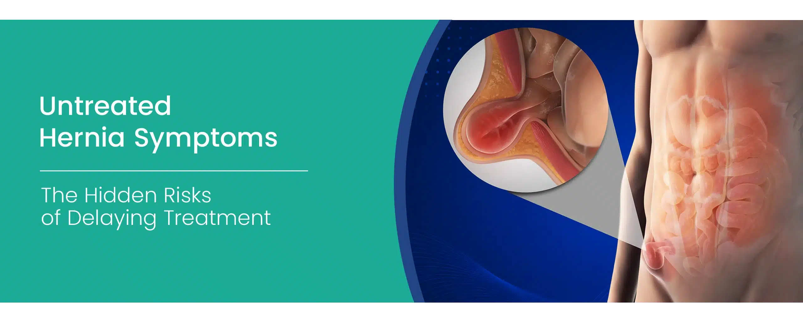 Untreated hernia symptoms