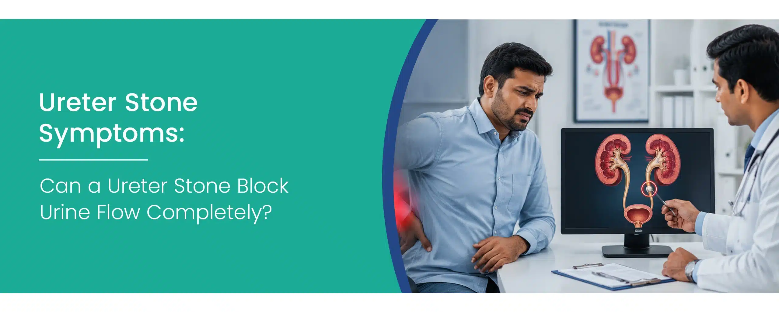 Ureter stone symptoms