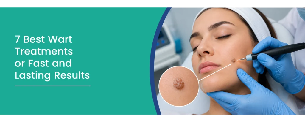 7 Best Wart Treatment