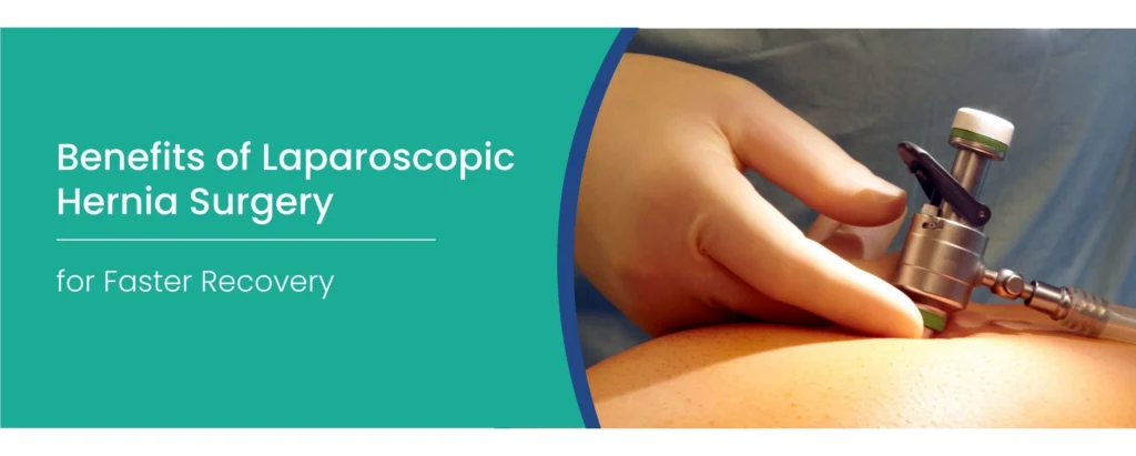 Laparoscopic hernia surgery