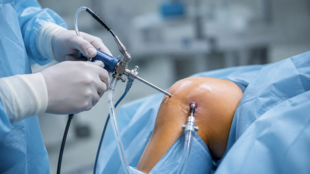 Arthroscopy