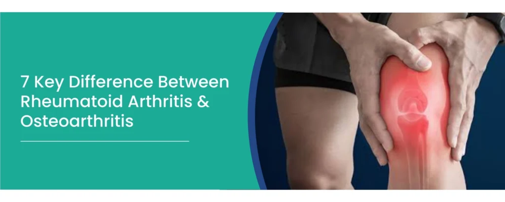 Arthritis