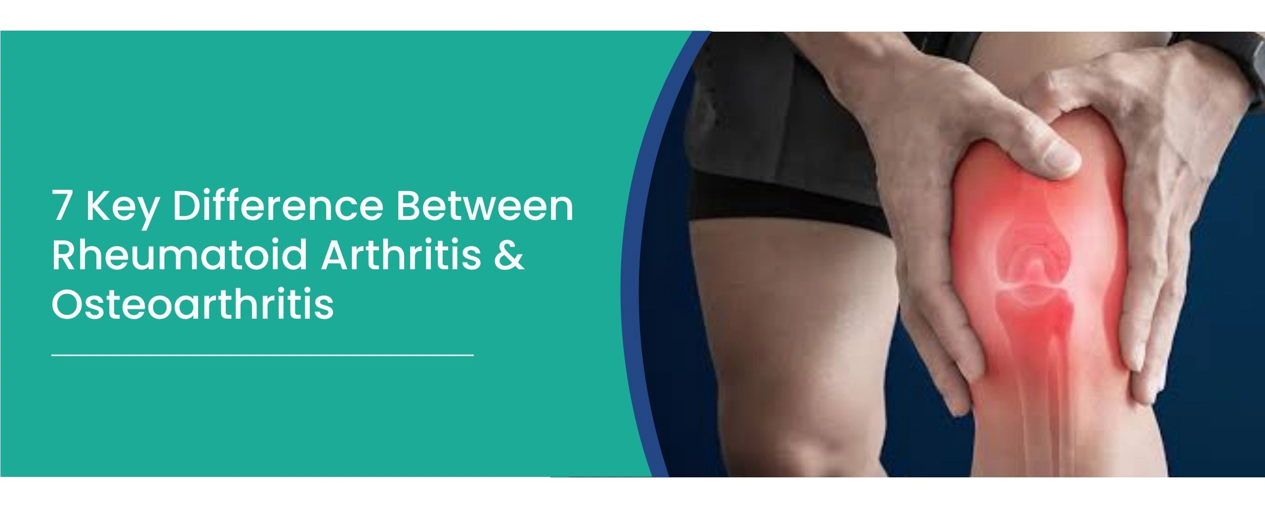 Arthritis