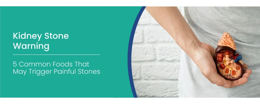 Foods that cause kidney stones