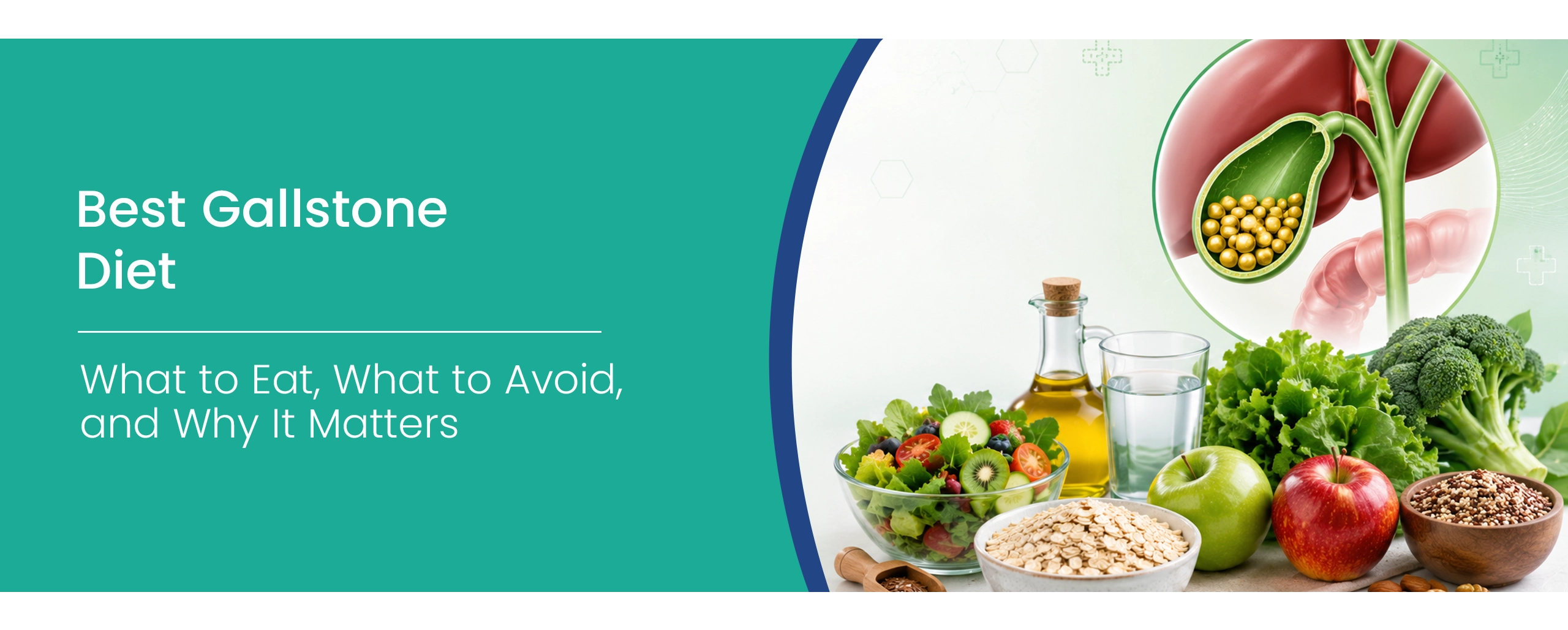 gallbladder stone diet