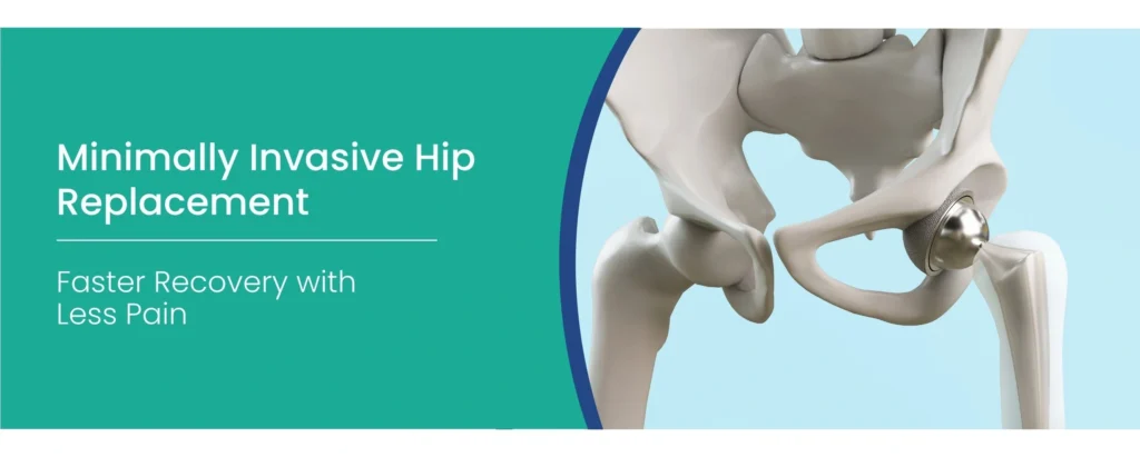 Minimally Invasive Hip Replacement