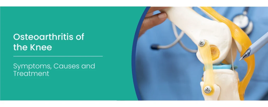 Osteoarthritis of the Knee