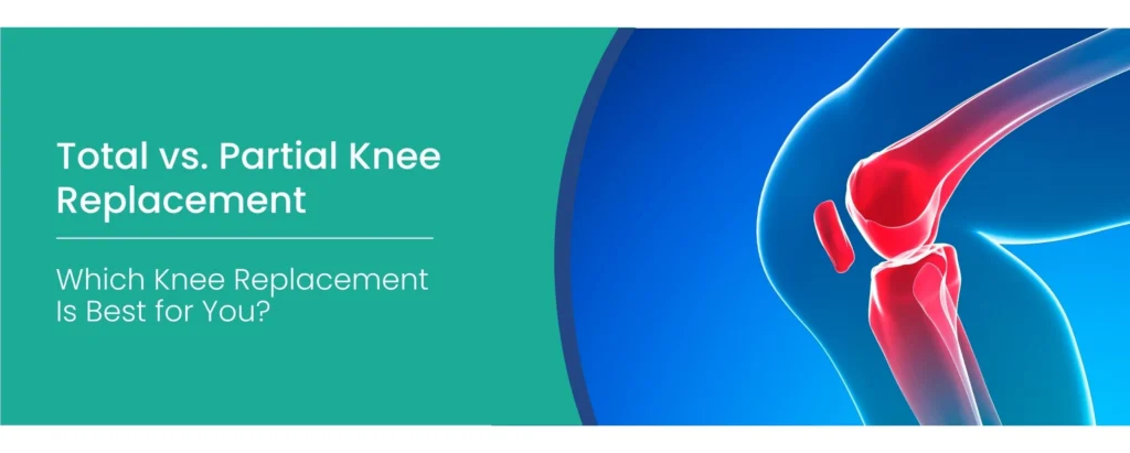 Total vs Partial Knee Replacement