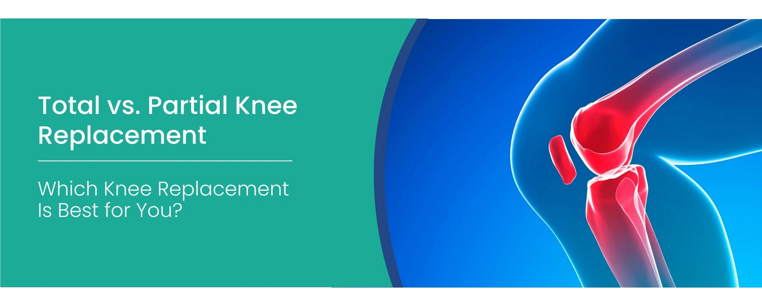 Total vs Partial Knee Replacement