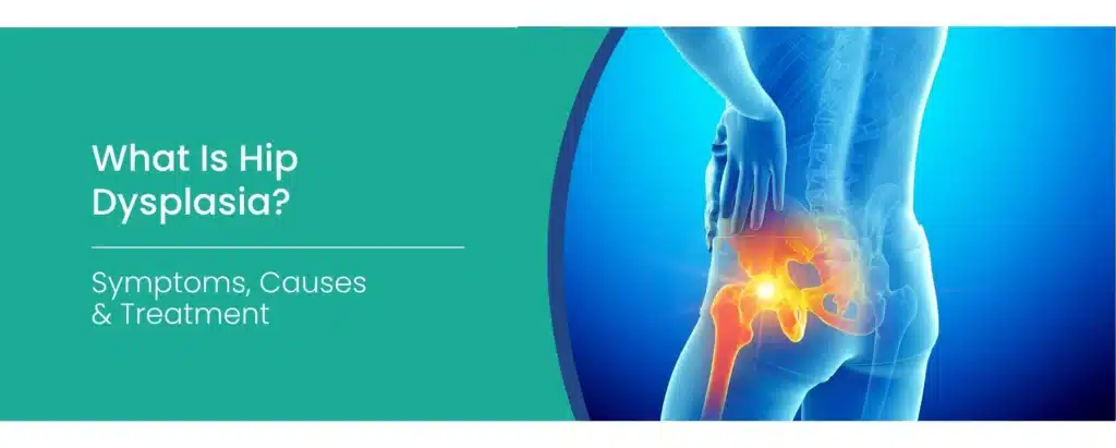 hip dysplasia