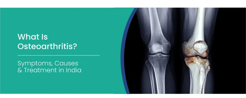 What Is Osteoarthritis
