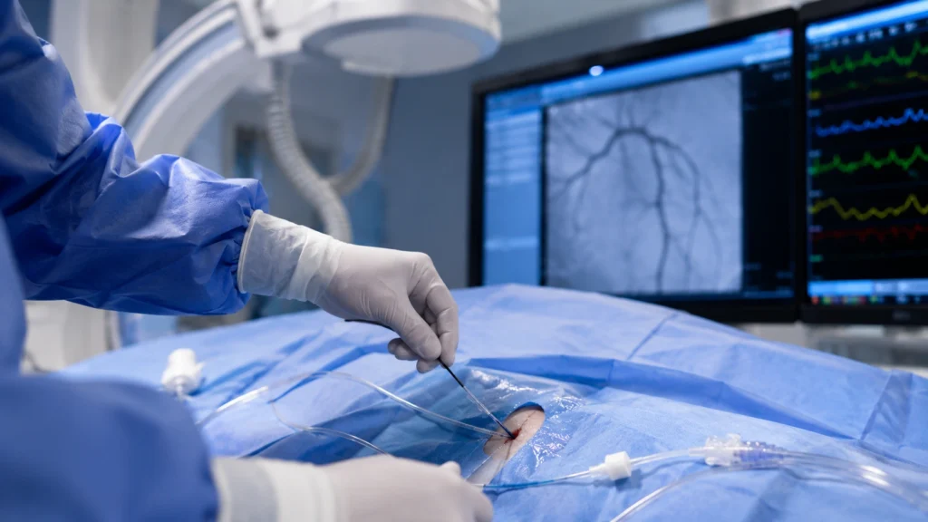 Angioplasty