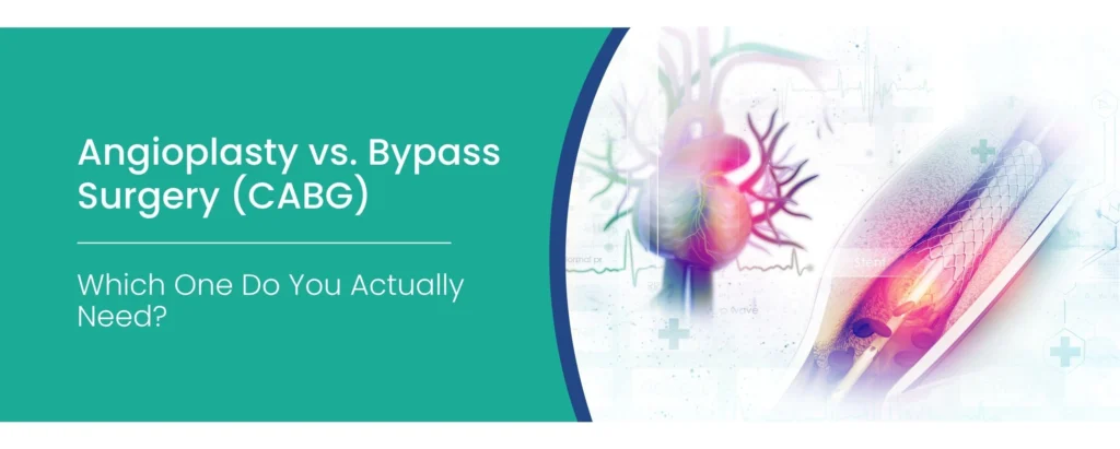 Bypass Surgery