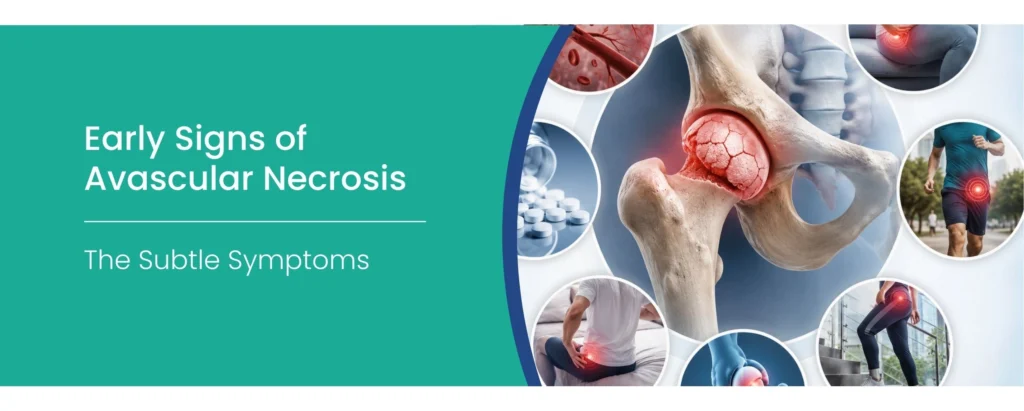 Signs of Avascular Necrosis