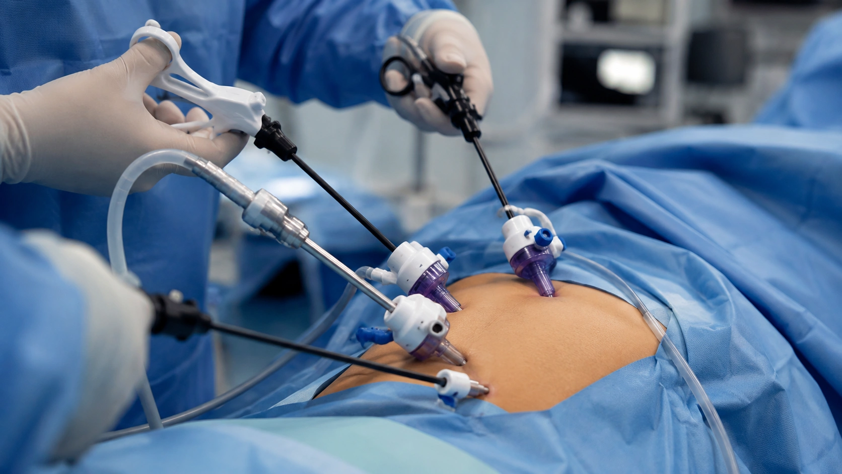 Open Hernia Repair