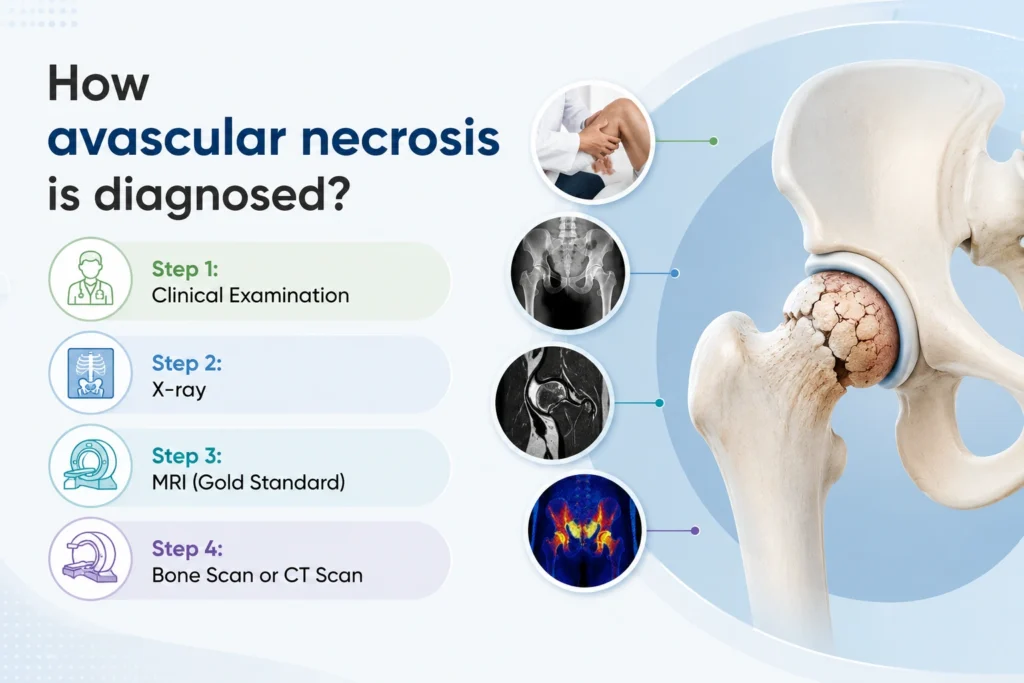 How avascular necrosis is diagnosed?