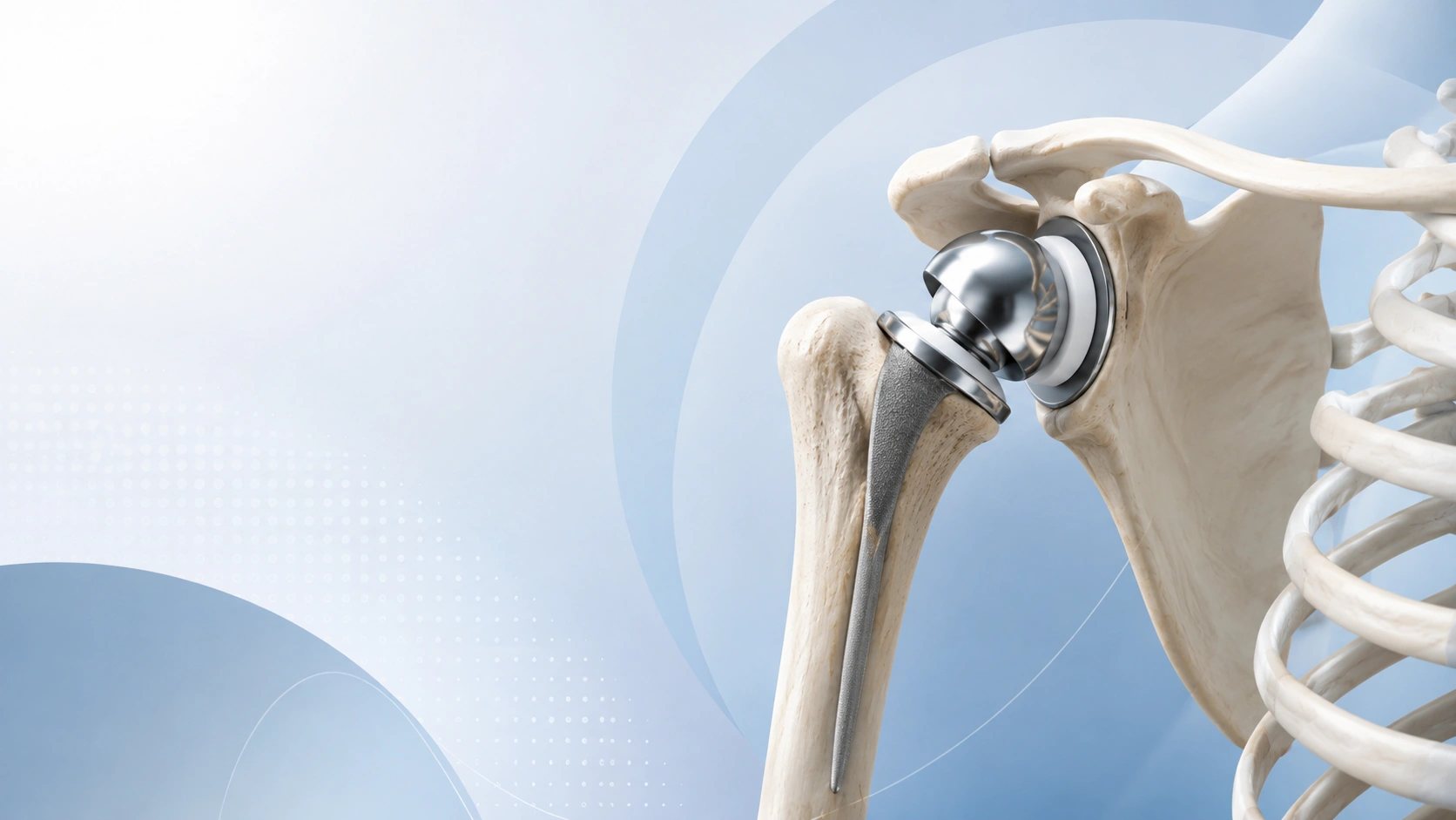 Shoulder replacement