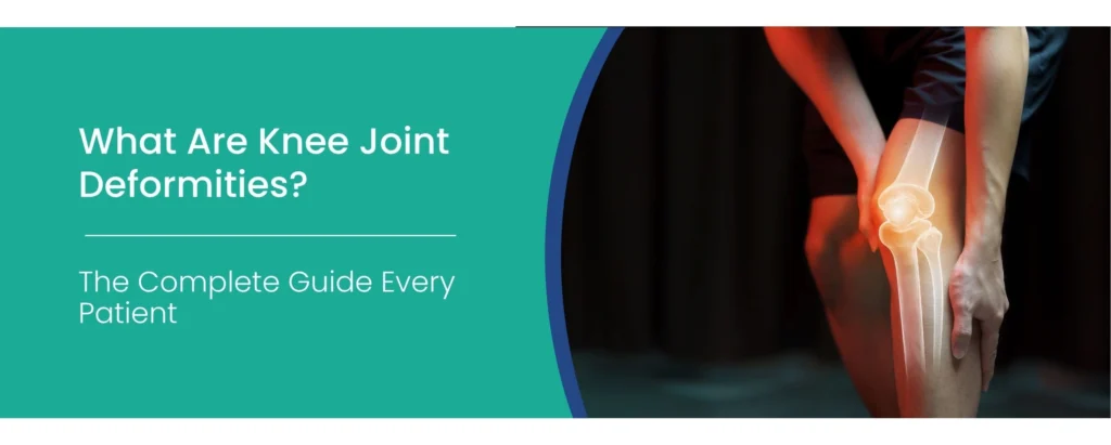 Knee Joint Deformities