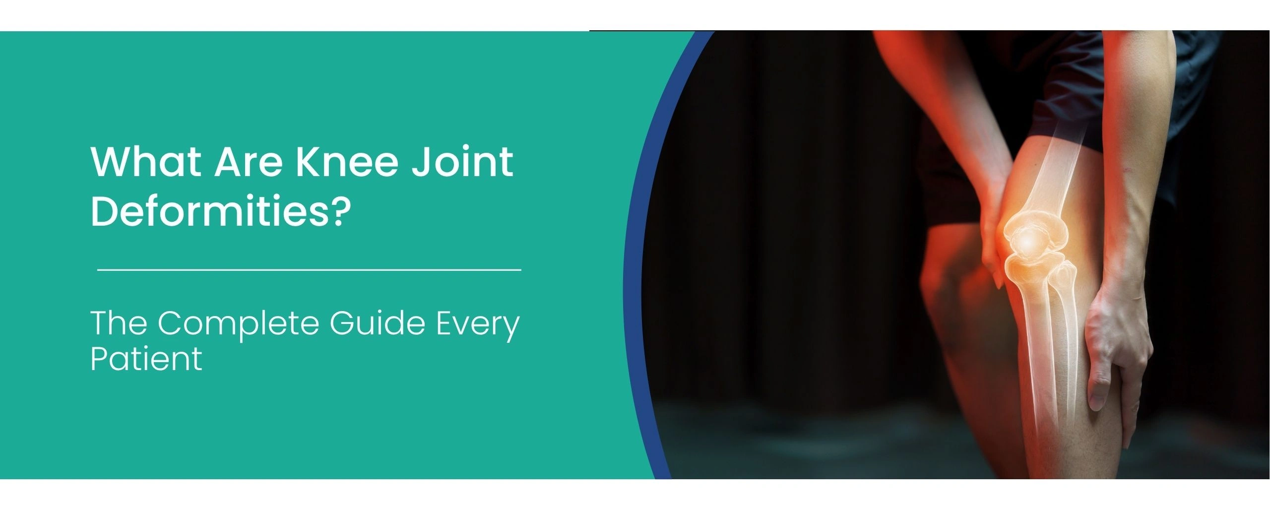 Knee Joint Deformities