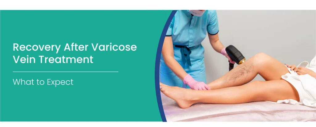 Varicose vein treatment recovery