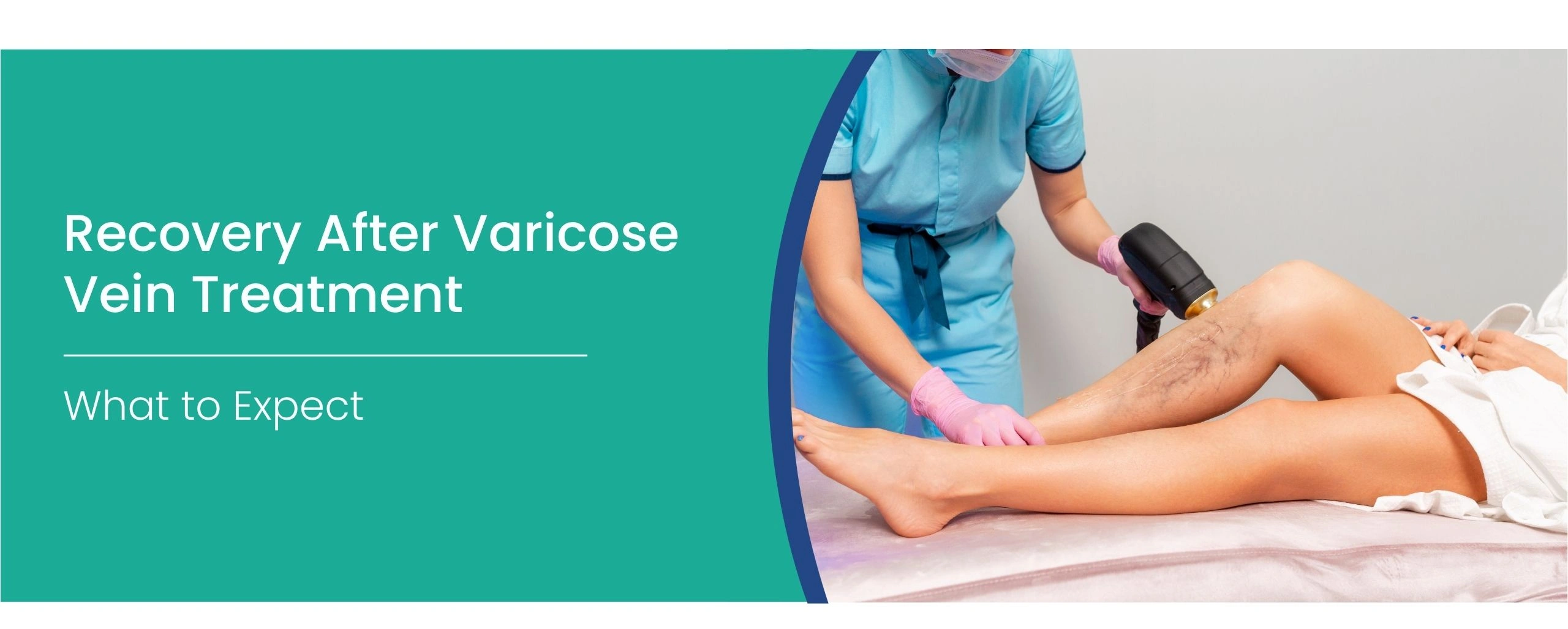 Varicose vein treatment recovery