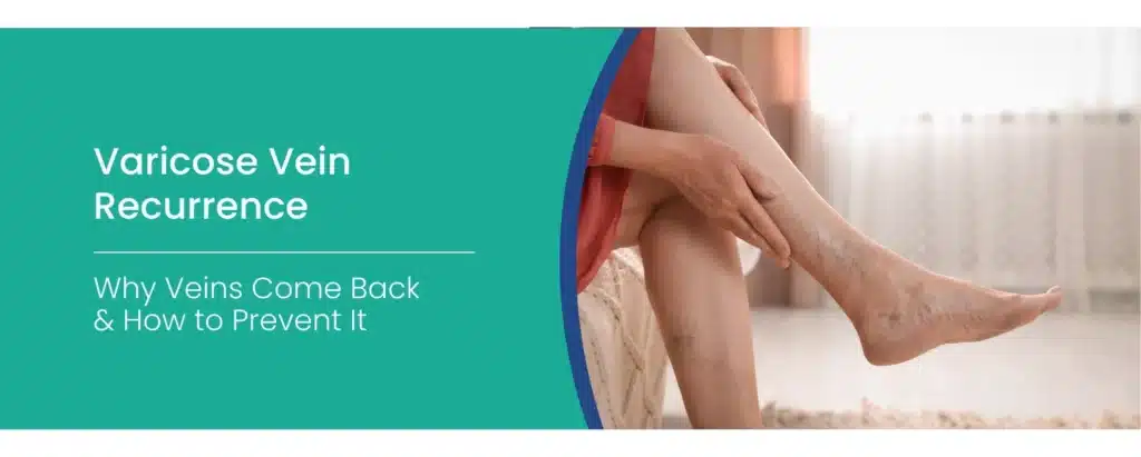 Varicose vein recurrence
