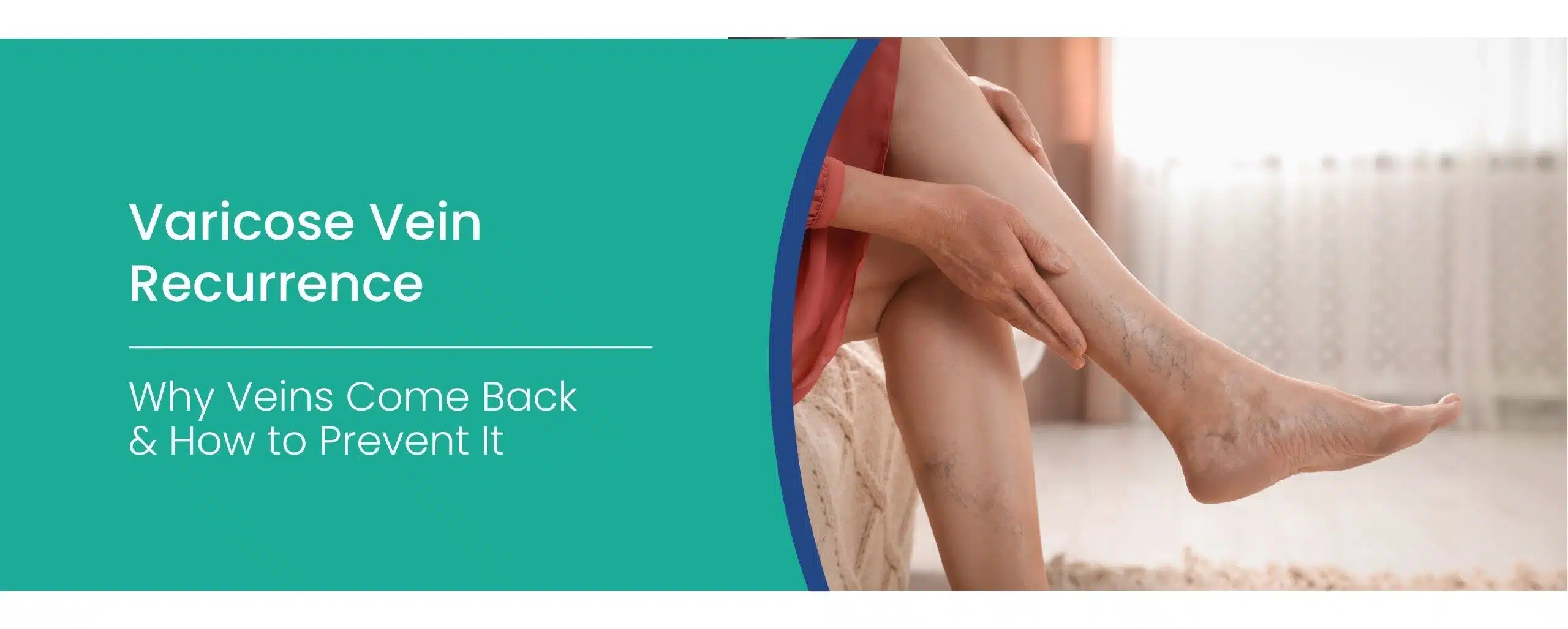 Varicose vein recurrence