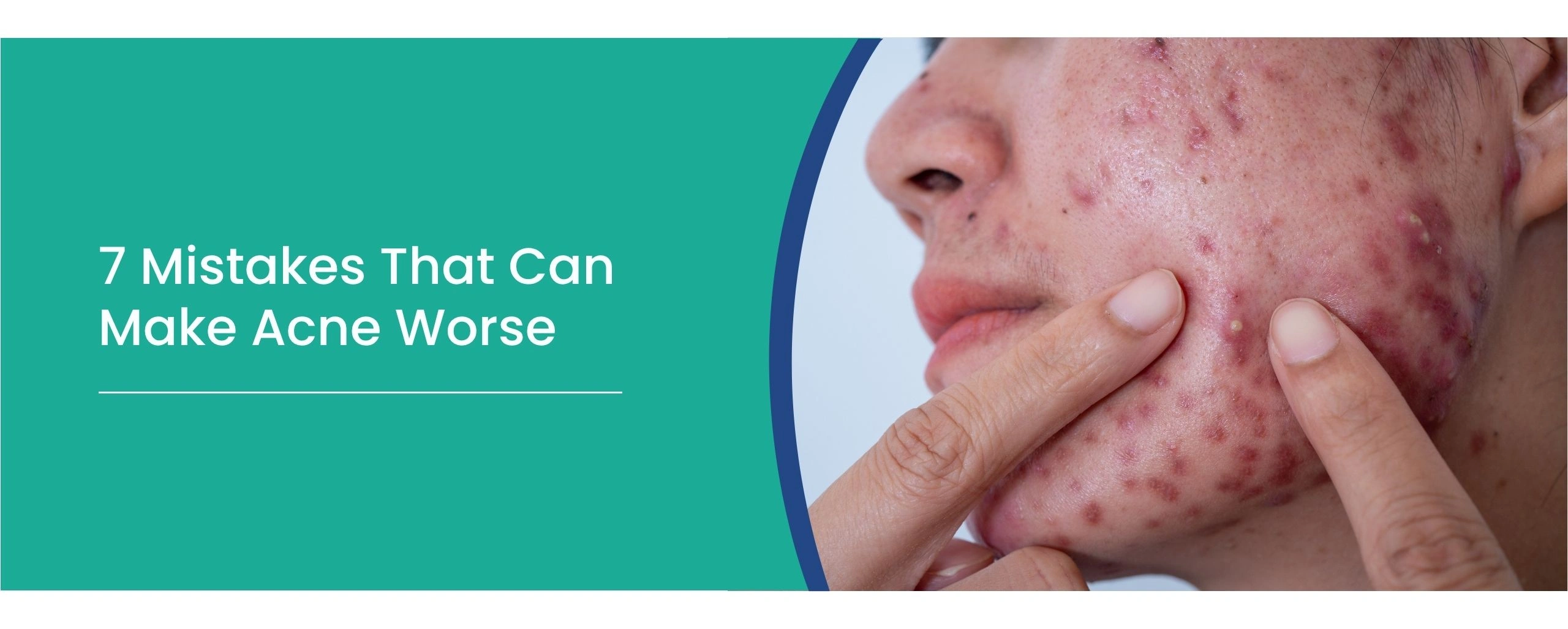 acne worse