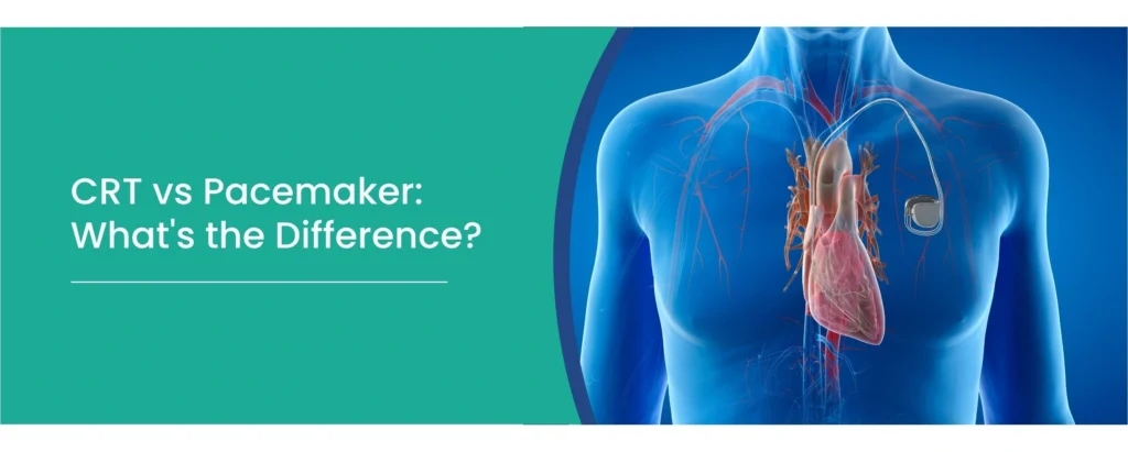 CRT vs Pacemaker