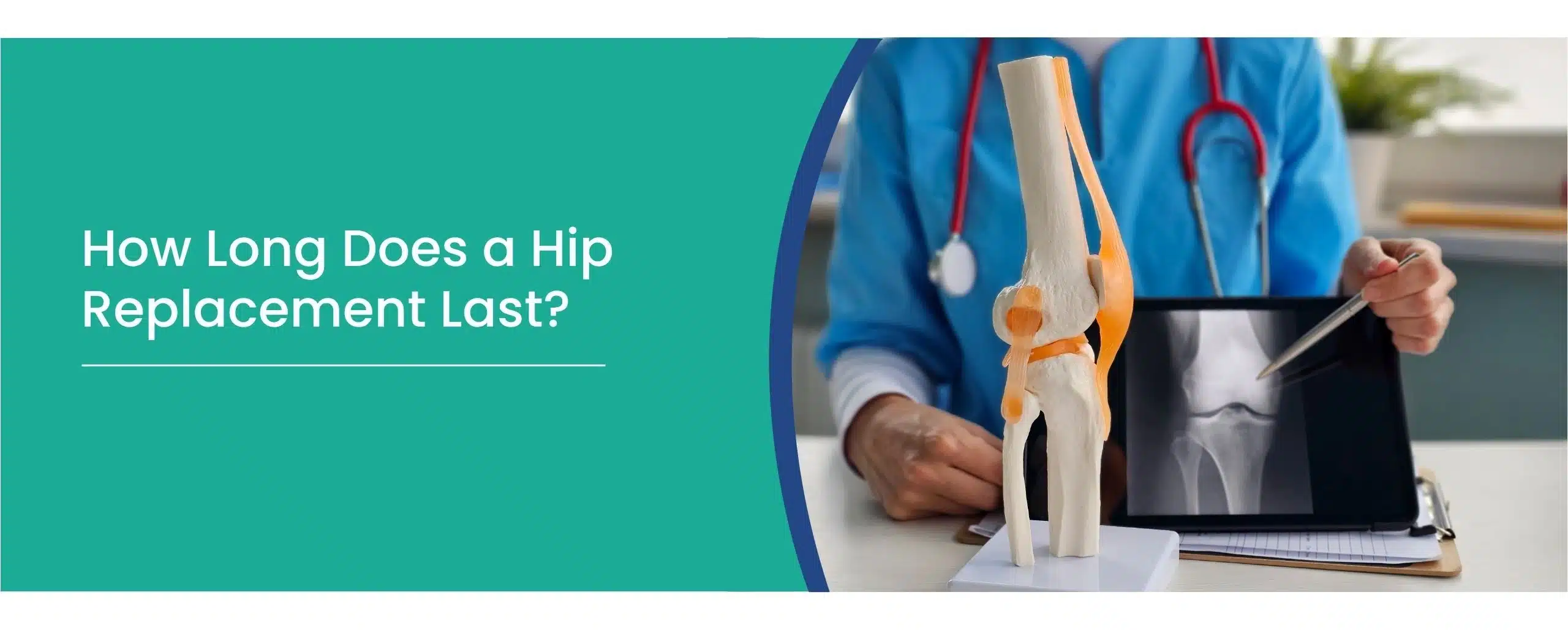 Hip Replacement