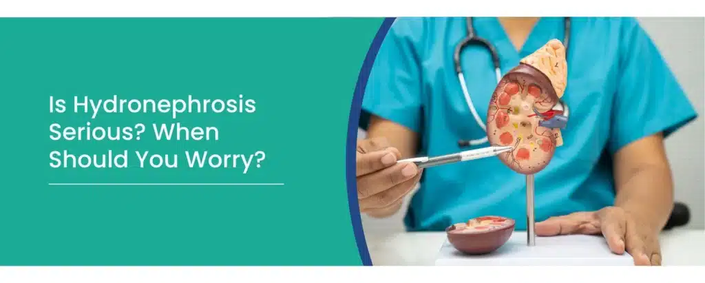 Hydronephrosis