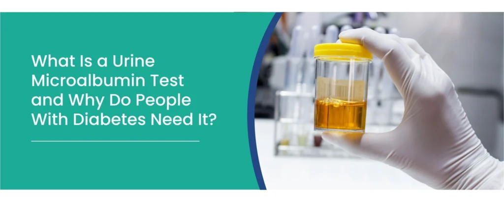 Urine Microalbumin Test