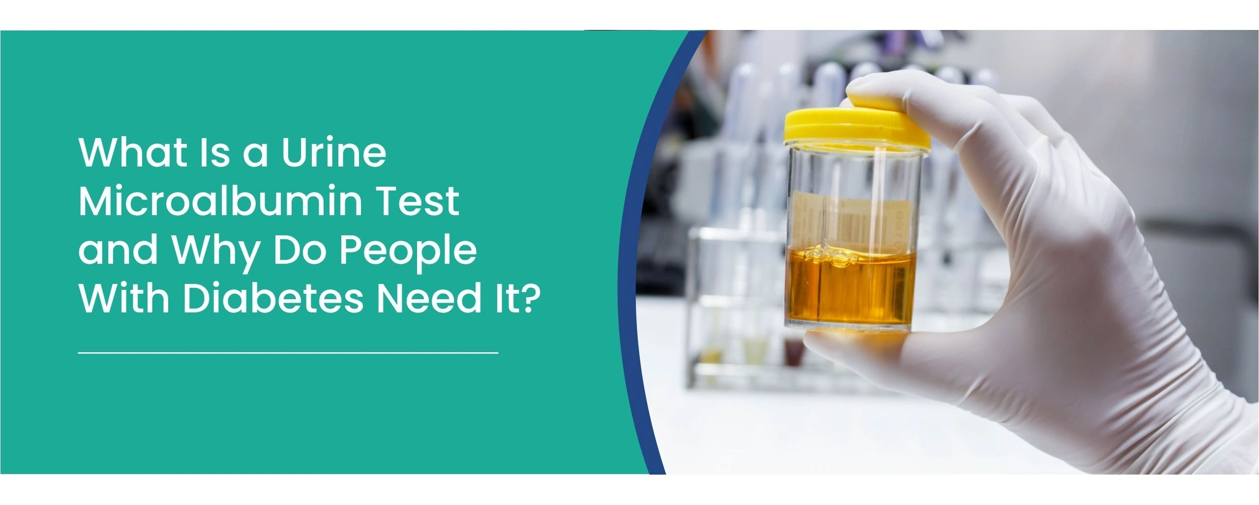 Urine Microalbumin Test