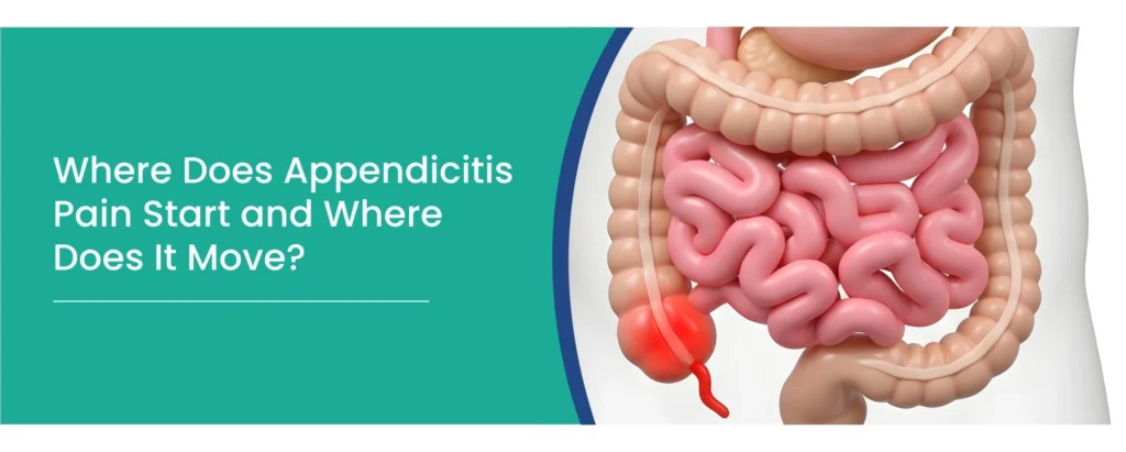 appendicitis pain